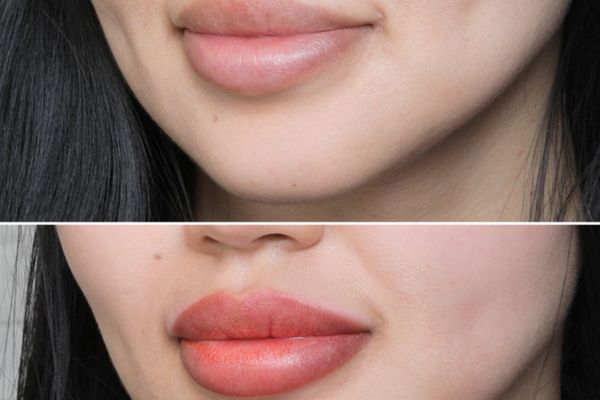 Hình ảnh trước và sau khi phun môi
