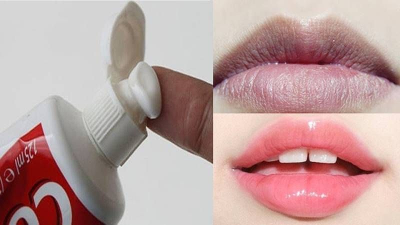 9 cách trị thâm môi bằng kem đánh răng hiệu quả có thể bạn chưa biết