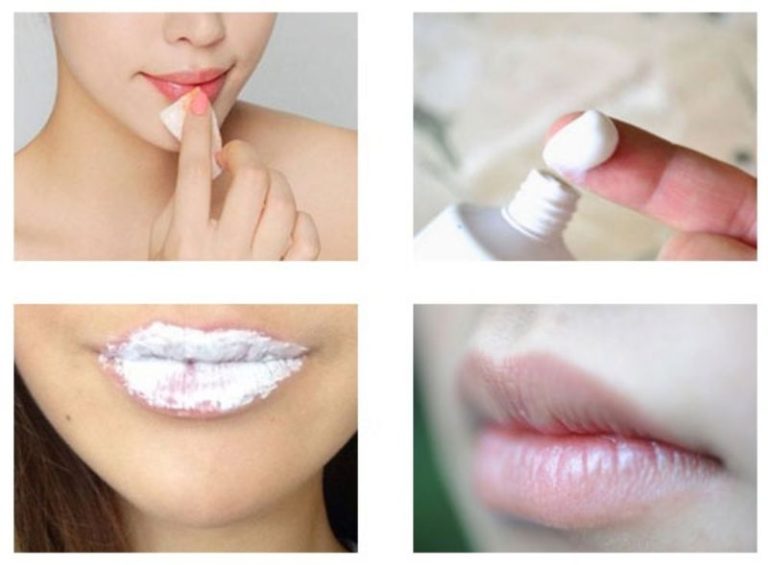 cách trị thâm môi bằng kem đánh răng